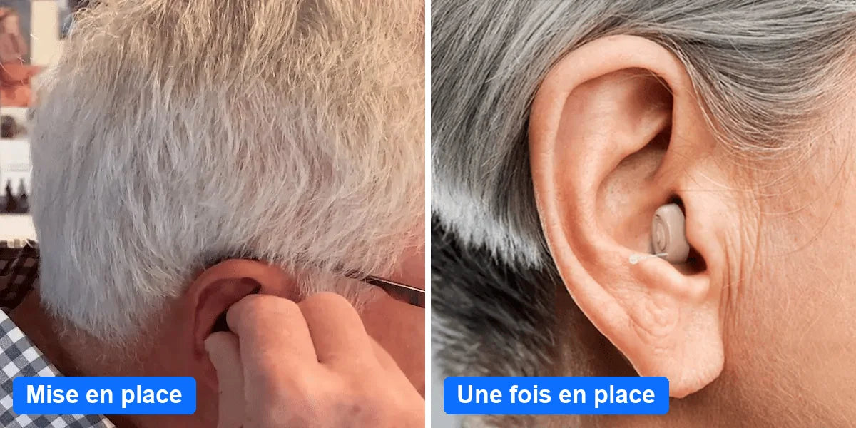 Mise en place de l'appareil dans l'oreille, puis une fois en place